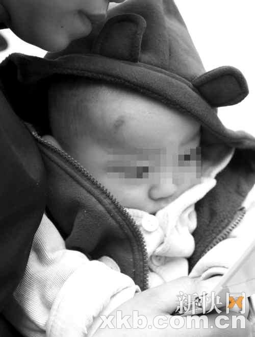 死里逃生的小孩子事发时受到惊吓。